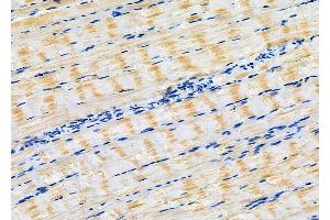 ABIN6266160 and ABIN6277132 at 1/100 staining Rat muscle tissue by IHC-P. (EIF2C3 抗体  (Internal Region))