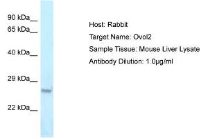 Host: Rabbit Target Name: Ovol2 Sample Type: Mouse Liver lysates Antibody Dilution: 1. (OVOL2 抗体  (Middle Region))