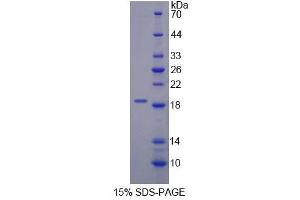 SDS-PAGE analysis of Human DARS Protein. (DARS 蛋白)