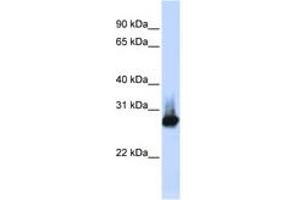 Image no. 1 for anti-B-Cell Receptor-Associated Protein 31 (BCAP31) (C-Term) antibody (ABIN6749735) (BCAP31 抗体  (C-Term))