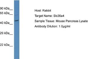 Host: Rabbit Target Name: SLC36A4 Sample Tissue: Mouse Pancreas Antibody Dilution: 1ug/ml (SLC36A4 抗体  (N-Term))