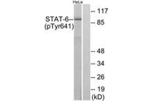 Western blot analysis of extracts from HeLa cells treated with IL-4, using STAT6 (Phospho-Tyr641) Antibody. (STAT6 抗体  (pTyr641))