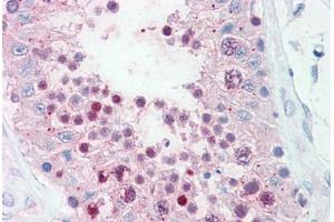 Anti-SLITRK6 antibody  ABIN960818 IHC staining of human testis. (SLITRK6 抗体  (Cytoplasmic Domain))