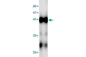 Western blot analysis in ECs2841 recombinant protein with ECs2841 monoclonal antibody, clone 5f4s6  at 1 : 1000 dilution. (ECs2841 抗体  (AA 23-338))