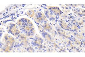 Detection of PIGR in Mouse Stomach Tissue using Polyclonal Antibody to Polymeric Immunoglobulin Receptor (PIGR) (PIGR 抗体  (AA 135-237))