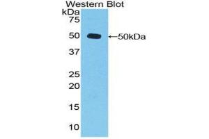 Western Blotting (WB) image for anti-Dishevelled, Dsh Homolog 3 (Drosophila) (DVL3) (AA 545-716) antibody (ABIN1858676) (DVL3 抗体  (AA 545-716))