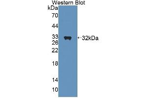 Western blot analysis of recombinant Rat SHP. (NR0B2 抗体  (AA 1-260))