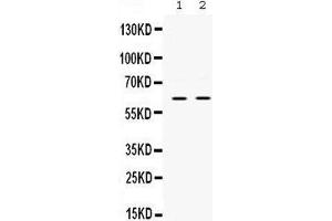 Western blot analysis of PAK3 expression in rat brain extract (lane 1) and mouse brain extract (lane 2). (PAK3 抗体  (N-Term))