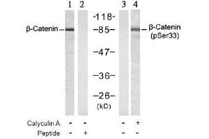 Image no. 3 for anti-Catenin (Cadherin-Associated Protein), beta 1, 88kDa (CTNNB1) (pSer33) antibody (ABIN196956) (CTNNB1 抗体  (pSer33))