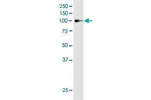 Western Blotting (WB) image for anti-Mitogen-Activated Protein Kinase Kinase Kinase 13 (MAP3K13) (AA 711-810) antibody (ABIN522632)