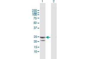 Western Blotting (WB) image for anti-ATP Synthase, H+ Transporting, Mitochondrial F1 Complex, O Subunit (ATP5O) (AA 1-213) antibody (ABIN513642)