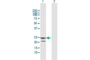 Western Blot analysis of ATP5O expression in transfected 293T cell line by ATP5O MaxPab polyclonal antibody. (ATP5O 抗体  (AA 1-213))