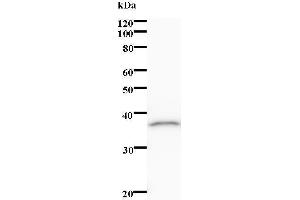 Western Blotting (WB) image for anti-ALX Homeobox 1 (ALX1) antibody (ABIN931200) (ALX1 抗体)