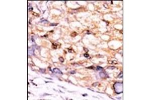 Immunohistochemistry (Paraffin-embedded Sections) (IHC (p)) image for anti-CTD (Carboxy-terminal Domain, RNA Polymerase II, Polypeptide A) Small Phosphatase 1 (CTDSP1) (AA 235-261), (C-Term) antibody (ABIN392888)