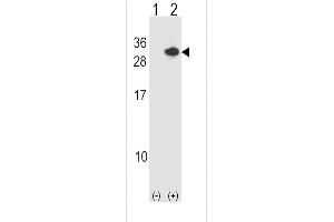 Western blot analysis of RCAN1 using rabbit polyclonal RCAN1 Antibody using 293 cell lysates (2 ug/lane) either nontransfected (Lane 1) or transiently transfected (Lane 2) with the RCAN1 gene. (RCAN1 抗体  (N-Term))