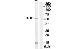 Western blot analysis of extracts from K562 cells, using PTGIS antibody. (PTGIS 抗体)