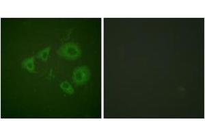 Immunofluorescence analysis of HuvEc cells, using Trk B (Phospho-Tyr705) Antibody. (TRKB 抗体  (pTyr706))