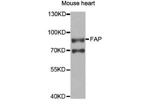 Western blot analysis of extracts of Mouse heart cell line, using FAP antibody. (FAP 抗体)