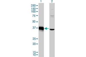 Western Blot analysis of MEOX2 expression in transfected 293T cell line by MEOX2 monoclonal antibody (M03), clone 6A5.