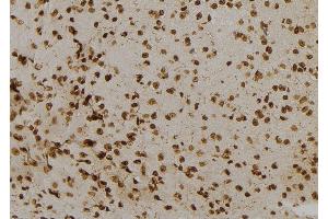ABIN6277122 at 1/100 staining Mouse brain tissue by IHC-P. (NUMBL 抗体  (C-Term))