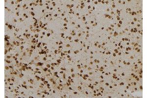 ABIN6277122 at 1/100 staining Mouse brain tissue by IHC-P.