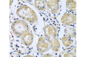 Immunohistochemistry of paraffin-embedded Human stomach using FBXL5 Polyclonal Antibody at dilution of 1:100 (40x lens). (FBXL5 抗体)