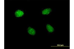 Immunofluorescence of monoclonal antibody to HEY1 on HeLa cell. (HEY1 抗体  (AA 121-220))