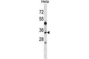 Western blot analysis in Hela cell line lysates (35ug/lane) using LAT2 / WBSCR15  Antibody . (LAT2 抗体  (Middle Region))