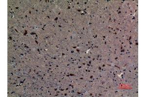 Immunohistochemistry (IHC) analysis of paraffin-embedded Mouse Brain, antibody was diluted at 1:100. (UBE2A/B (C-Term) 抗体)