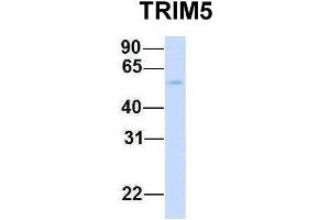 Western Blotting (WB) image for anti-Tripartite Motif Containing 5 (TRIM5) (N-Term) antibody (ABIN2778419)