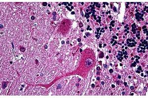 Human Brain, Cerebellum: Formalin-Fixed, Paraffin-Embedded (FFPE) (Huntingtin 抗体  (AA 81-191))