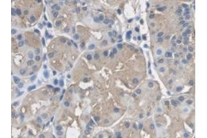 DAB staining on IHC-P; Samples: Human Stomach Tissue)