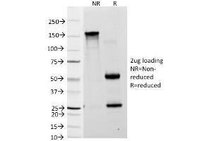 SDS-PAGE Analysis Purified Lewis A Monoclonal Antibody (7LE). (Blood Group Lewis A 抗体)