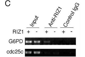 Image no. 3 for anti-PR Domain Containing 2, with ZNF Domain (PRDM2) antibody (ABIN2995299) (PRDM2 抗体)