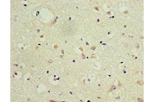 Immunohistochemistry of paraffin-embedded human brain tissue using ABIN7153991 at dilution of 1:100 (GRIN2B 抗体  (AA 1185-1484))