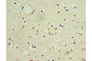 Immunohistochemistry of paraffin-embedded human brain tissue using ABIN7153991 at dilution of 1:100