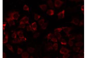 ABIN6274735 staining COLO205 by IF/ICC. (MRPL21 抗体  (Internal Region))