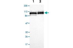 Western Blot analysis of Lane 1: RT-4 and Lane 2: U-251MG sp cell lysates with MCM4 polyclonal antibody . (MCM4 抗体)