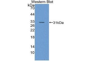 Western Blotting (WB) image for anti-Glutathione S-Transferase theta 1 (GSTT1) (AA 7-240) antibody (ABIN1868284) (GSTT1 抗体  (AA 7-240))
