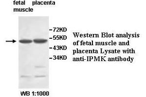 Image no. 1 for anti-Inositol Polyphosphate Multikinase (IPMK) antibody (ABIN1577290) (IPMK 抗体)