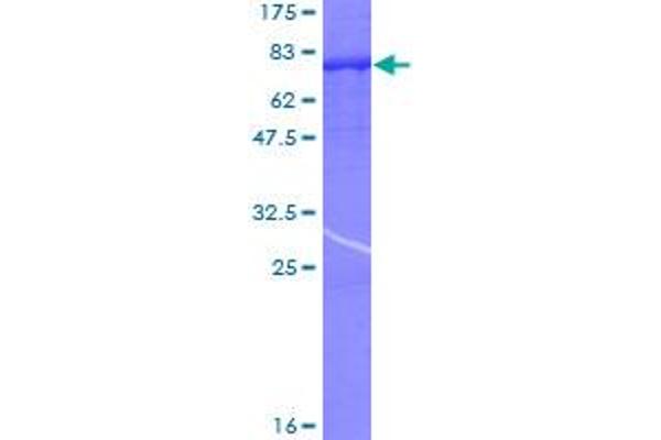 PPP3CC Protein (AA 1-512) (GST tag)