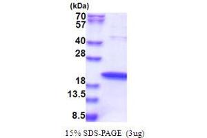 SDS-PAGE (SDS) image for Zinc Finger, HIT-Type Containing 1 (ZNHIT1) (AA 1-154) protein (His tag) (ABIN5853634) (ZNHIT1 Protein (AA 1-154) (His tag))
