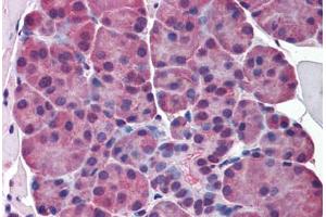 Immunohistochemistry (Formalin-fixed Paraffin-embedded Sections) (IHC (fp)) image for anti-E74-Like Factor 5 (Ets Domain Transcription Factor) (ELF5) (AA 101-150) antibody (ABIN768772)