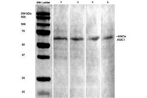 Western Blot analysis of Rat brain lysates showing detection of ASIC1 protein using Mouse Anti-ASIC1 Monoclonal Antibody, Clone S271-44 . (ASIC1 抗体  (AA 460-526) (Biotin))