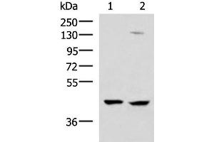 Western blot analysis of 293T and Jurkat cell lysates using MAGEC2 Polyclonal Antibody at dilution of 1:850 (MAGEC2 抗体)