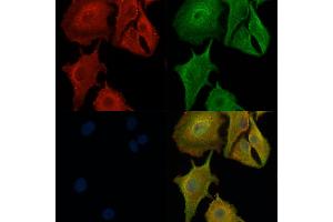 ABIN6258880 and ABIN6276245 staining  cells by IF/ICC.