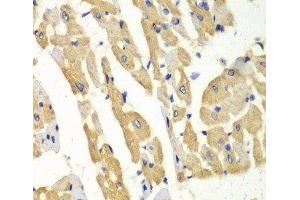Immunohistochemistry of paraffin-embedded Mouse heart using HNMT Polyclonal Antibody at dilution of 1:100 (40x lens). (HNMT 抗体)