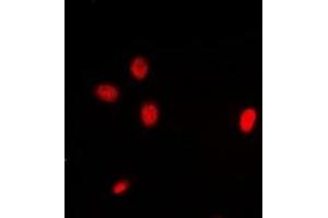 Immunofluorescent analysis of ING3 staining in Hela cells. (ING3 抗体)