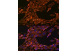 Immunofluorescence analysis of NIH-3T3 cells using HE4/WFDC2 Rabbit mAb (ABIN1682653, ABIN3017632, ABIN3017633 and ABIN7101513) at dilution of 1:100 (40x lens). (WFDC2 抗体)