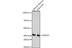 Western blot analysis of extracts of various cell lines, using SMYD3 Rabbit mAb (ABIN3015902, ABIN3015903, ABIN1680302 and ABIN1680303) at 1:1000 dilution. (SMYD3 抗体)